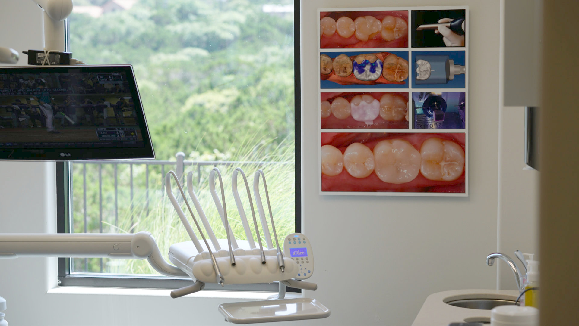 Cerec-Story-on-wall